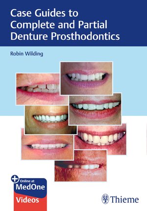 Buchcover Case Guides to Complete and Partial Denture Prosthodontics | Robin Wilding | EAN 9781684201709 | ISBN 1-68420-170-5 | ISBN 978-1-68420-170-9