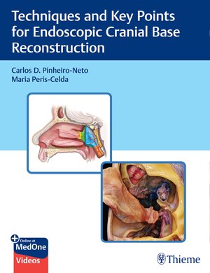 Buchcover Techniques and Key Points for Endoscopic Cranial Base Reconstruction | Carlos Pinheiro-Neto | EAN 9781684202324 | ISBN 1-68420-232-9 | ISBN 978-1-68420-232-4