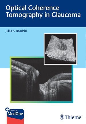 Buchcover Optical Coherence Tomography in Glaucoma | Jullia Rosdahl | EAN 9781684202485 | ISBN 1-68420-248-5 | ISBN 978-1-68420-248-5