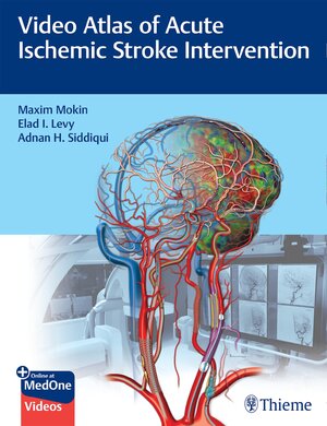 Buchcover Video Atlas of Acute Ischemic Stroke Intervention | Maxim Mokin | EAN 9781684202492 | ISBN 1-68420-249-3 | ISBN 978-1-68420-249-2