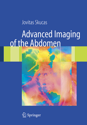Buchcover Advanced Imaging of the Abdomen | Jovitas Skucas | EAN 9781846281693 | ISBN 1-84628-169-5 | ISBN 978-1-84628-169-3