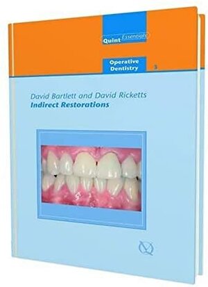 Buchcover Indirect Restorations, Quintessentials of Dental Practice Vol 25 | David Bartlett, David Ricketts | EAN 9781850970781 | ISBN 1-85097-078-5 | ISBN 978-1-85097-078-1