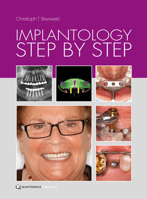 Buchcover Implantology Step by Step | Christoph T. Sliwowski | EAN 9781850972815 | ISBN 1-85097-281-8 | ISBN 978-1-85097-281-5