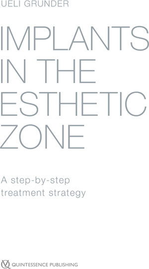 Buchcover Implants in the Esthetic Zone | Ueli Grunder | EAN 9781850972839 | ISBN 1-85097-283-4 | ISBN 978-1-85097-283-9