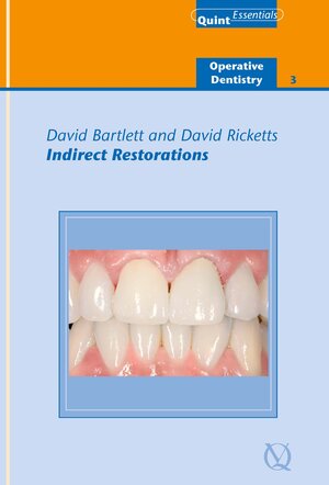 Buchcover Indirect Restorations | David Bartlett | EAN 9781850973010 | ISBN 1-85097-301-6 | ISBN 978-1-85097-301-0