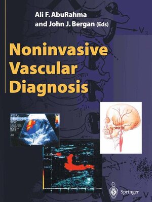 Buchcover Noninvasive Vascular Diagnosis  | EAN 9781852331283 | ISBN 1-85233-128-3 | ISBN 978-1-85233-128-3