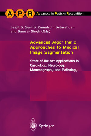 Buchcover Advanced Algorithmic Approaches to Medical Image Segmentation | EAN 9781852333898 | ISBN 1-85233-389-8 | ISBN 978-1-85233-389-8