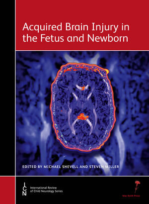 Buchcover Acquired Brain Injury in the Fetus and Newborn | Michael Shevell | EAN 9781907655029 | ISBN 1-907655-02-6 | ISBN 978-1-907655-02-9