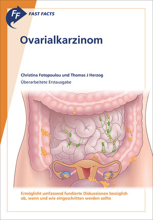 Buchcover Fast Facts: Ovarialkarzinom | Christina Fotopoulou | EAN 9781910797822 | ISBN 1-910797-82-0 | ISBN 978-1-910797-82-2