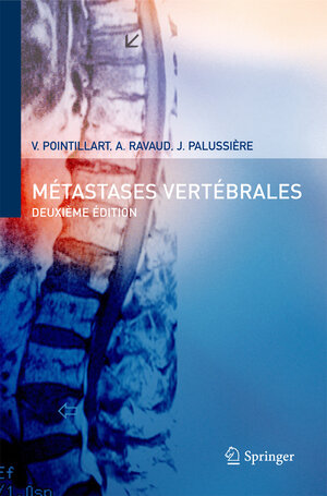 Buchcover Métastases vertébrales | Vincent Pointillart | EAN 9782287337437 | ISBN 2-287-33743-1 | ISBN 978-2-287-33743-7