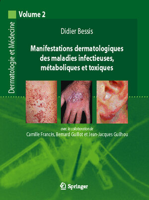 Buchcover Manifestations dermatologiques des maladies infectieuses, métaboliques et toxiques | Didier Bessis | EAN 9782287484940 | ISBN 2-287-48494-9 | ISBN 978-2-287-48494-0