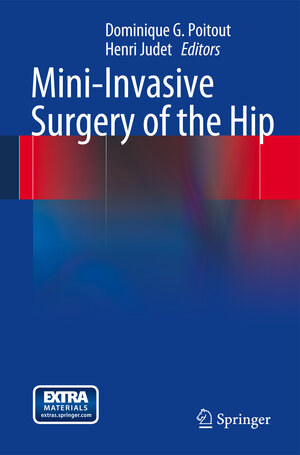 Buchcover Mini-Invasive Surgery of the Hip | EAN 9782287799303 | ISBN 2-287-79930-3 | ISBN 978-2-287-79930-3