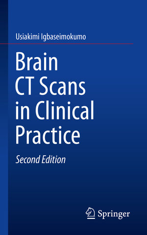 Buchcover Brain CT Scans in Clinical Practice | Usiakimi Igbaseimokumo | EAN 9783030148270 | ISBN 3-030-14827-0 | ISBN 978-3-030-14827-0