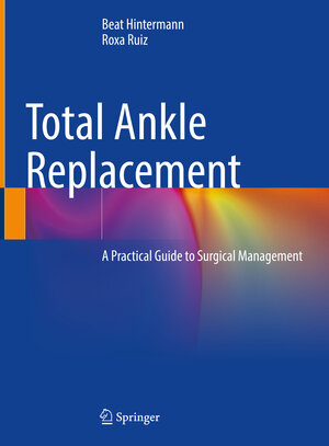 Buchcover Total Ankle Replacement | Beat Hintermann | EAN 9783031568107 | ISBN 3-031-56810-9 | ISBN 978-3-031-56810-7