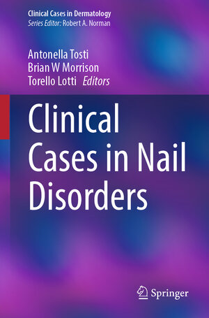 Buchcover Clinical Cases in Nail Disorders  | EAN 9783031886416 | ISBN 3-031-88641-0 | ISBN 978-3-031-88641-6