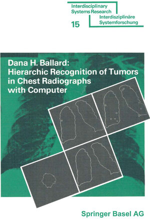 Buchcover Hierarchic Recognition of Tumors in Chest Radiographs with Computer | BALLARD | EAN 9783034855020 | ISBN 3-0348-5502-8 | ISBN 978-3-0348-5502-0