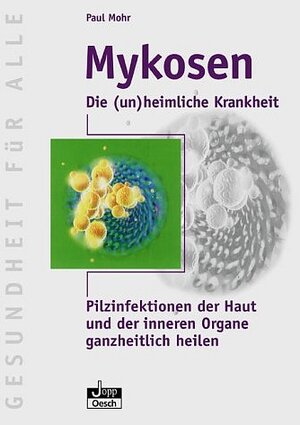 Mykosen-die (un)heimliche Krankheit: Pilzinfektionen der Haut und der inneren Organe ganzheitlich heilen