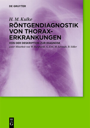 Buchcover Röntgendiagnostik von Thoraxerkrankungen | H. M. Kulke | EAN 9783110311181 | ISBN 3-11-031118-6 | ISBN 978-3-11-031118-1