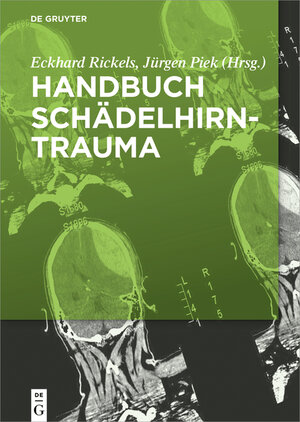 Buchcover Handbuch Schädel-Hirn-Trauma  | EAN 9783110366860 | ISBN 3-11-036686-X | ISBN 978-3-11-036686-0