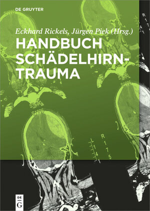 Buchcover Handbuch Schädelhirntrauma  | EAN 9783110372342 | ISBN 3-11-037234-7 | ISBN 978-3-11-037234-2