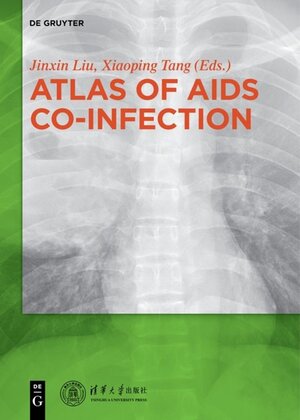 Buchcover Atlas of AIDS Co-infection  | EAN 9783110387902 | ISBN 3-11-038790-5 | ISBN 978-3-11-038790-2