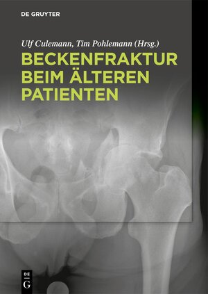 Buchcover Beckenfraktur beim älteren Patienten  | EAN 9783110421934 | ISBN 3-11-042193-3 | ISBN 978-3-11-042193-4