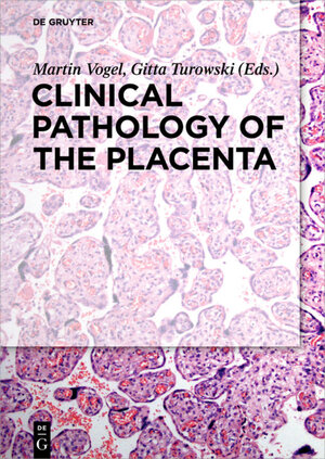 Buchcover Clinical Pathology of the Placenta  | EAN 9783110449976 | ISBN 3-11-044997-8 | ISBN 978-3-11-044997-6
