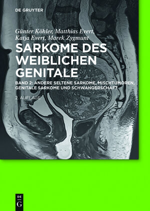 Buchcover Sarkome des weiblichen Genitale / Andere seltene Sarkome, Mischtumoren, genitale Sarkome und Schwangerschaft | Günter Köhler | EAN 9783110451344 | ISBN 3-11-045134-4 | ISBN 978-3-11-045134-4