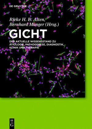 Buchcover Gicht  | EAN 9783110451382 | ISBN 3-11-045138-7 | ISBN 978-3-11-045138-2