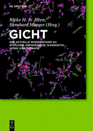 Buchcover Gicht  | EAN 9783110452976 | ISBN 3-11-045297-9 | ISBN 978-3-11-045297-6