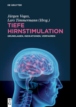 Buchcover Tiefe Hirnstimulation | EAN 9783110459722 | ISBN 3-11-045972-8 | ISBN 978-3-11-045972-2