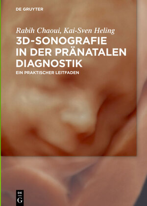 Buchcover 3D-Sonografie in der pränatalen Diagnostik | Rabih Chaoui | EAN 9783110471762 | ISBN 3-11-047176-0 | ISBN 978-3-11-047176-2