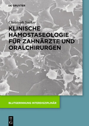 Buchcover Klinische Hämostaseologie für Zahnärzte und Oralchirurgen | Christoph Sucker | EAN 9783110490961 | ISBN 3-11-049096-X | ISBN 978-3-11-049096-1