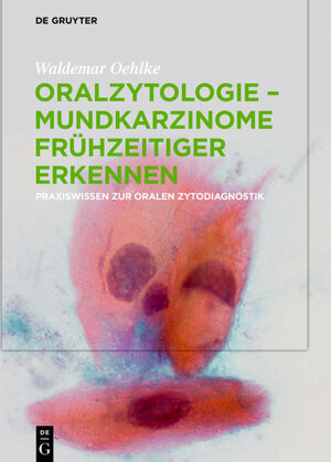 Buchcover Oralzytologie - Mundkarzinome frühzeitiger erkennen | Waldemar Oehlke | EAN 9783110627503 | ISBN 3-11-062750-7 | ISBN 978-3-11-062750-3