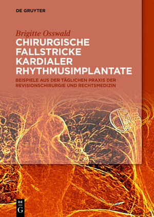 Buchcover Chirurgische Fallstricke kardialer Rhythmusimplantate | Brigitte Osswald | EAN 9783110636963 | ISBN 3-11-063696-4 | ISBN 978-3-11-063696-3