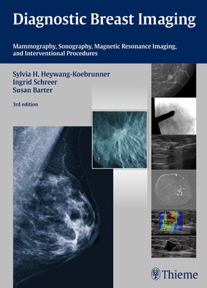 Buchcover Diagnostic Breast Imaging | Sylvia H. Heywang-Köbrunner | EAN 9783131028938 | ISBN 3-13-102893-9 | ISBN 978-3-13-102893-8