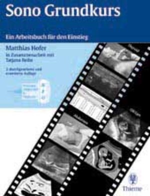 Buchcover Sono-Grundkurs | Matthias Hofer | EAN 9783131029133 | ISBN 3-13-102913-7 | ISBN 978-3-13-102913-3