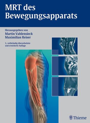 Buchcover MRT des Bewegungsapparats | Martin Vahlensieck | EAN 9783131036834 | ISBN 3-13-103683-4 | ISBN 978-3-13-103683-4