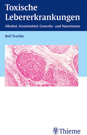 Toxische Lebererkrankungen. Alkohol, Arzneimittel, Gewerbe- und Naturtoxine