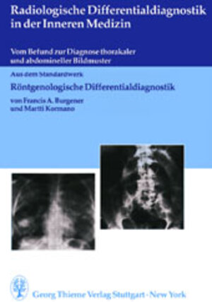 Buchcover Radiologische Differentialdiagnostik in der Inneren Medizin | Francis A Burgener | EAN 9783131064813 | ISBN 3-13-106481-1 | ISBN 978-3-13-106481-3