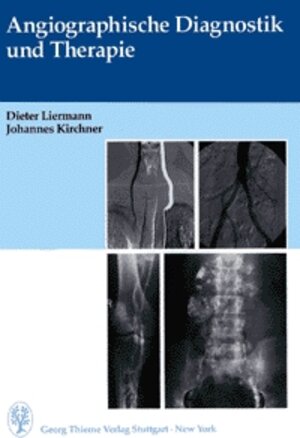 Buchcover Angiographische Diagnostik und Therapie | Dieter Liermann | EAN 9783131083111 | ISBN 3-13-108311-5 | ISBN 978-3-13-108311-1