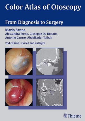 Buchcover Color Atlas of Otoscopy | Alessandra Russo | EAN 9783131114921 | ISBN 3-13-111492-4 | ISBN 978-3-13-111492-1