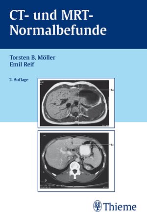 Buchcover CT und MRT Normalbefunde | Torsten Bert Möller | EAN 9783131124227 | ISBN 3-13-112422-9 | ISBN 978-3-13-112422-7