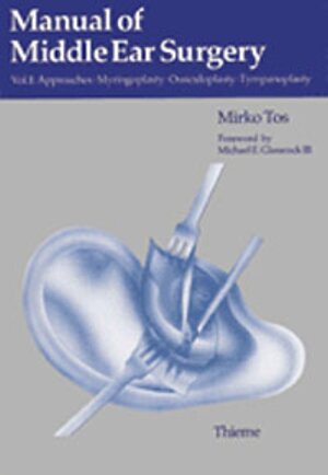 Buchcover Manual of Middle Ear Surgery | Mirko Tos | EAN 9783131127013 | ISBN 3-13-112701-5 | ISBN 978-3-13-112701-3