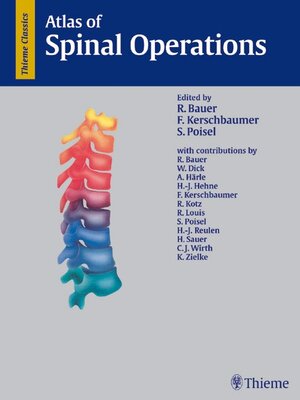 Buchcover Atlas of Spinal Operations  | EAN 9783131140012 | ISBN 3-13-114001-1 | ISBN 978-3-13-114001-2