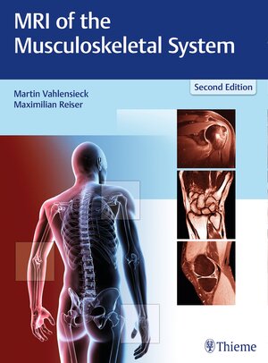 Buchcover MRI of the Musculoskeletal System  | EAN 9783131165725 | ISBN 3-13-116572-3 | ISBN 978-3-13-116572-5