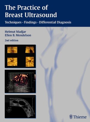 Buchcover The Practice of Breast Ultrasound | Helmut Madjar | EAN 9783131243423 | ISBN 3-13-124342-2 | ISBN 978-3-13-124342-3
