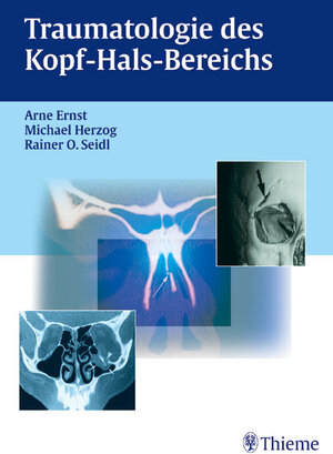 Buchcover Traumatologie des Kopf-Hals-Bereichs | Arne Ernst | EAN 9783131260918 | ISBN 3-13-126091-2 | ISBN 978-3-13-126091-8