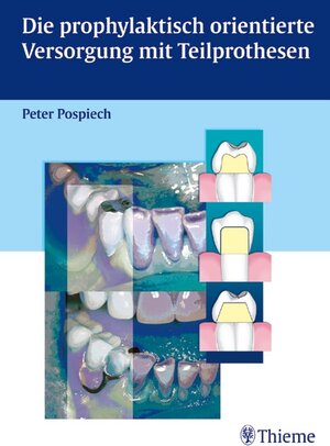 Buchcover Die prophylaktisch orientierte Versorgung mit Teilprothesen | Peter Pospiech | EAN 9783131269416 | ISBN 3-13-126941-3 | ISBN 978-3-13-126941-6