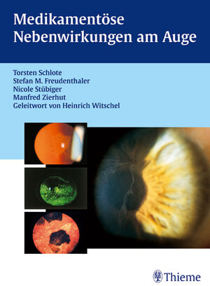 Buchcover Medikamentöse Nebenwirkungen am Auge | Torsten Schlote | EAN 9783131290113 | ISBN 3-13-129011-0 | ISBN 978-3-13-129011-3